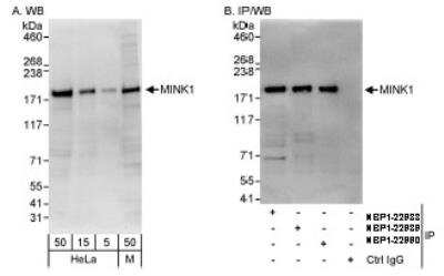 Western Blot: MAP4K6 Antibody [NBP1-22988]