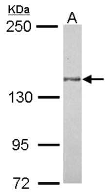 Western Blot: MAP4K6 Antibody [NBP2-17220]