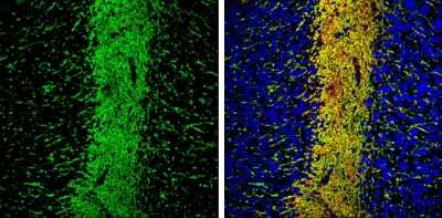 Immunohistochemistry-Frozen: MAP6 Antibody [NBP3-12961]