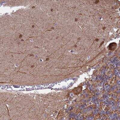 Immunohistochemistry: MAP6 Antibody [NBP2-14221]