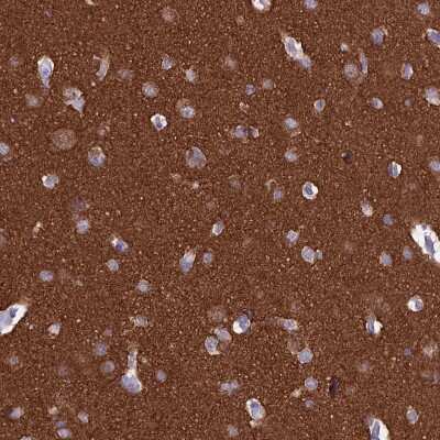 Immunohistochemistry-Paraffin: MAP6 Antibody [NBP2-14220]