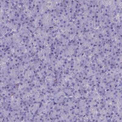 Immunohistochemistry-Paraffin: MAP6 Antibody [NBP2-14220]