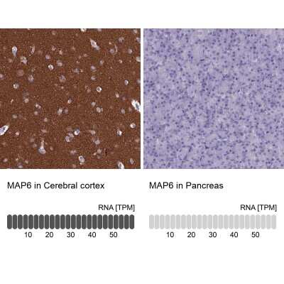 Immunohistochemistry-Paraffin: MAP6 Antibody [NBP2-14220]