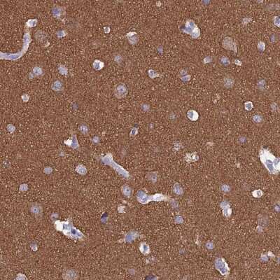 Immunohistochemistry-Paraffin: MAP6 Antibody [NBP2-14221]