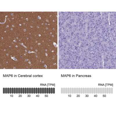 Immunohistochemistry-Paraffin: MAP6 Antibody [NBP2-14221]