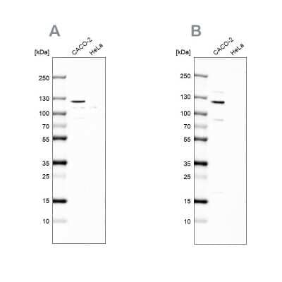 Western Blot: MAP6 Antibody [NBP2-14220]