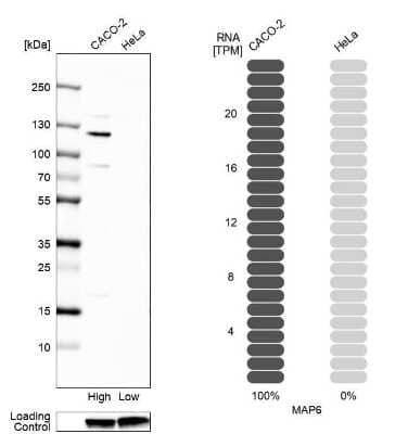 Western Blot: MAP6 Antibody [NBP2-14221]