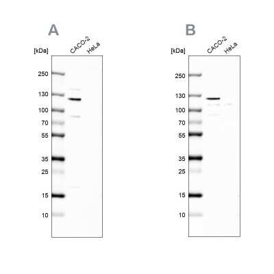 Western Blot: MAP6 Antibody [NBP2-14221]