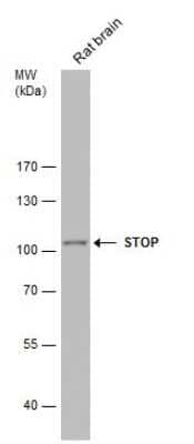 Western Blot: MAP6 Antibody [NBP3-12961]