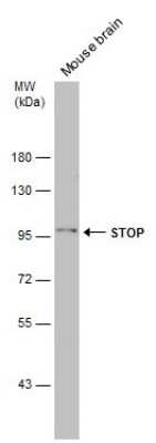 Western Blot: MAP6 Antibody [NBP3-12961]