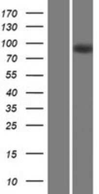 Western Blot: MAP6 Overexpression Lysate [NBP2-05928]