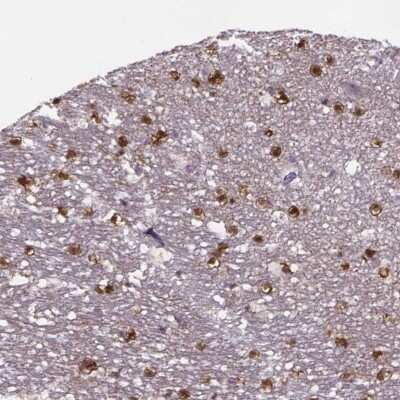 Immunohistochemistry-Paraffin: MAP6D1 Antibody [NBP1-94026]