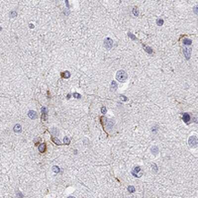 Immunohistochemistry-Paraffin: MAP6D1 Antibody [NBP1-94026]