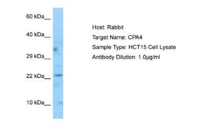 Western Blot: MAP6D1 Antibody [NBP2-85253]