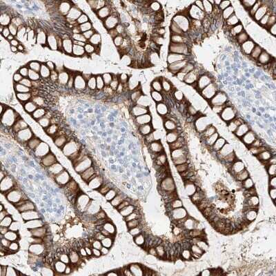 Immunohistochemistry-Paraffin: MAP7 Antibody [NBP1-84852]