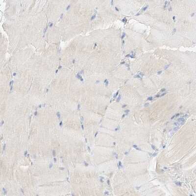 Immunohistochemistry-Paraffin: MAP7 Antibody [NBP1-84852]