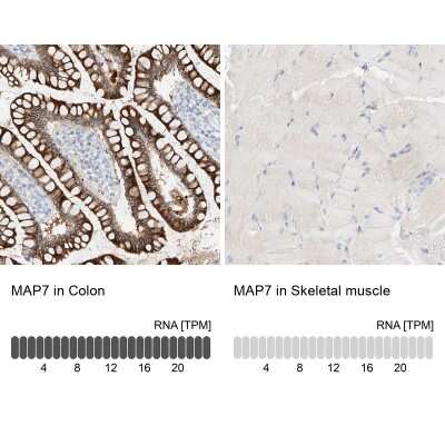 Immunohistochemistry-Paraffin: MAP7 Antibody [NBP1-84852]