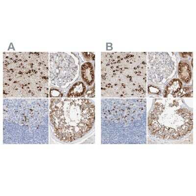 Immunohistochemistry-Paraffin: MAP7 Antibody [NBP1-84852]