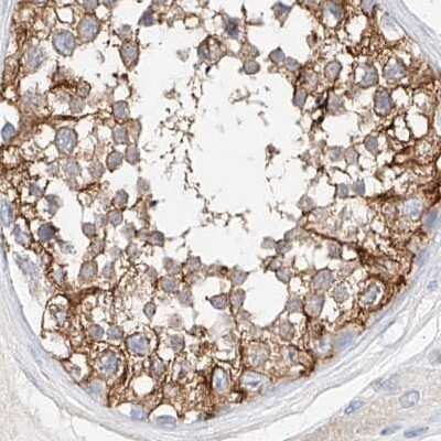 Immunohistochemistry-Paraffin: MAP7 Antibody [NBP1-84852]