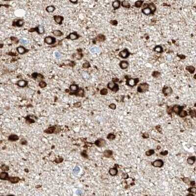 Immunohistochemistry-Paraffin: MAP7 Antibody [NBP1-84852]