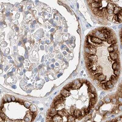 Immunohistochemistry-Paraffin: MAP7 Antibody [NBP1-84852]