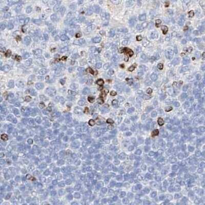 Immunohistochemistry-Paraffin: MAP7 Antibody [NBP1-84852]