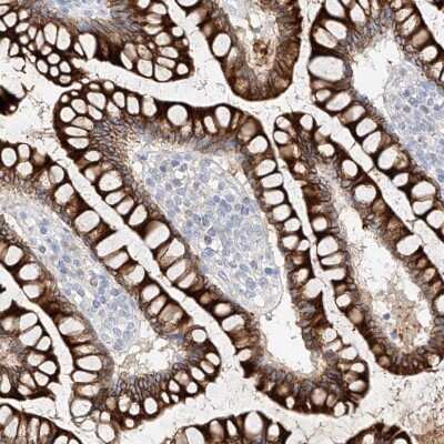 Immunohistochemistry-Paraffin: MAP7 Antibody [NBP1-84853]