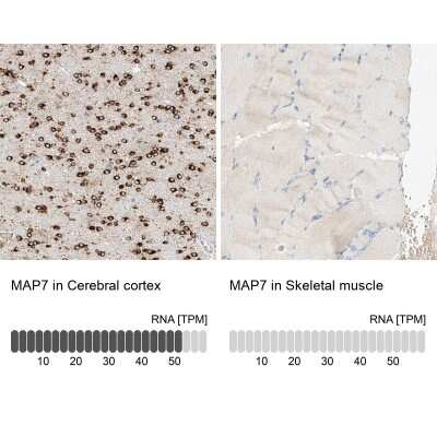 Immunohistochemistry-Paraffin: MAP7 Antibody [NBP1-84853]