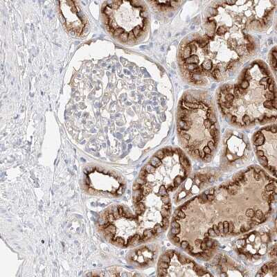 Immunohistochemistry-Paraffin: MAP7 Antibody [NBP1-84853]