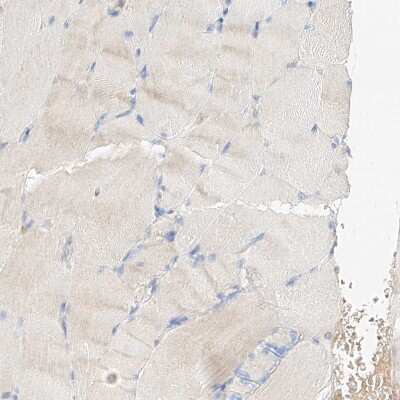Immunohistochemistry-Paraffin: MAP7 Antibody [NBP1-84853]
