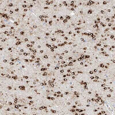 Immunohistochemistry-Paraffin: MAP7 Antibody [NBP1-84853]