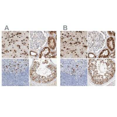 Immunohistochemistry-Paraffin: MAP7 Antibody [NBP1-84853]