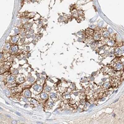 Immunohistochemistry-Paraffin: MAP7 Antibody [NBP1-84853]