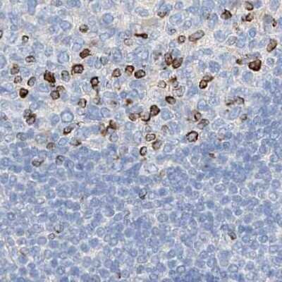 Immunohistochemistry-Paraffin: MAP7 Antibody [NBP1-84853]