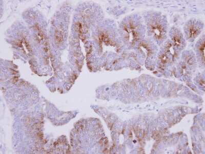 Immunohistochemistry-Paraffin: MAP7 Antibody [NBP2-17222]