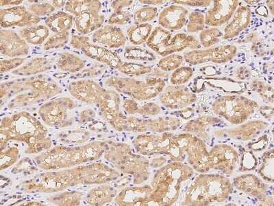 Immunohistochemistry-Paraffin: MAP7 Antibody [NBP2-97907]