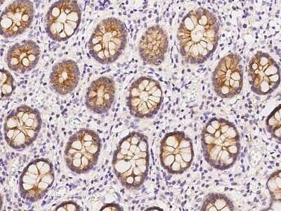 Immunohistochemistry-Paraffin: MAP7 Antibody [NBP2-97907]