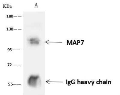 Immunoprecipitation: MAP7 Antibody [NBP2-97907]