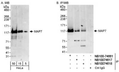 Western Blot: MAP7 Antibody [NB100-74618]