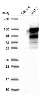 Western Blot: MAP7 Antibody [NBP1-84852]