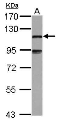 Western Blot: MAP7 Antibody [NBP2-17222]