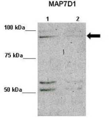 Western Blot: MAP7D1 Antibody [NBP1-70632]