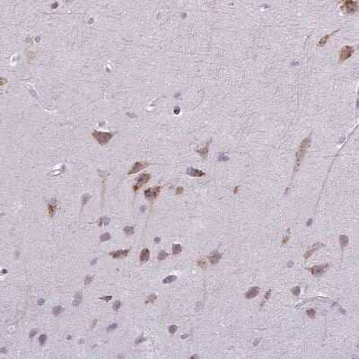 Immunohistochemistry-Paraffin: MAP7D2 Antibody [NBP2-14740]