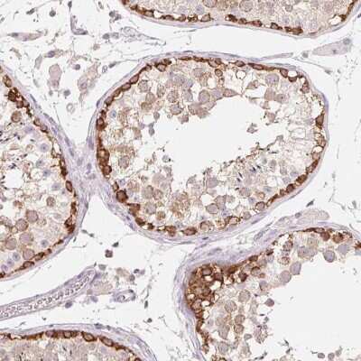 Immunohistochemistry-Paraffin: MAP7D2 Antibody [NBP2-49300]