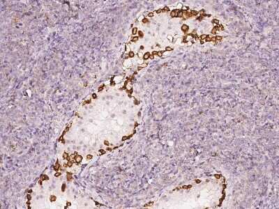 Immunohistochemistry-Paraffin: MAP7D2 Antibody [NBP2-97908]