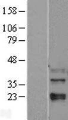 Western Blot: p38 beta/MAPK11 Overexpression Lysate [NBL1-12870]