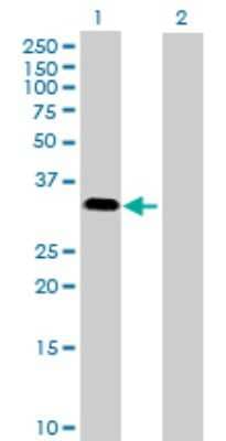 Western Blot: MAPK15 Antibody [H00225689-B01P]