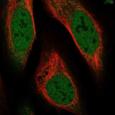 Immunocytochemistry/ Immunofluorescence: MAPK1IP1L Antibody [NBP1-88420]