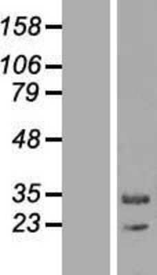 Western Blot: MAPK1IP1L Overexpression Lysate [NBL1-12876]