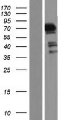 Western Blot: ERK4/MAPK4 Overexpression Lysate [NBP2-08072]